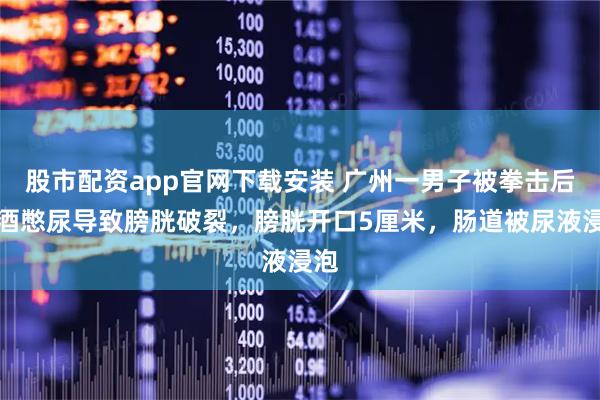 股市配资app官网下载安装 广州一男子被拳击后饮酒憋尿导致膀胱破裂，膀胱开口5厘米，肠道被尿液浸泡